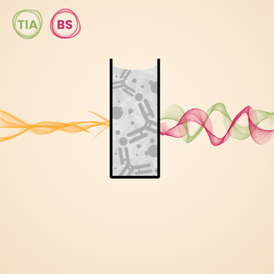 Lambda Immunoglobulins (serum & urine) Icon